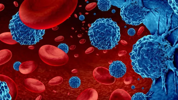 3D illustration of blood cancer